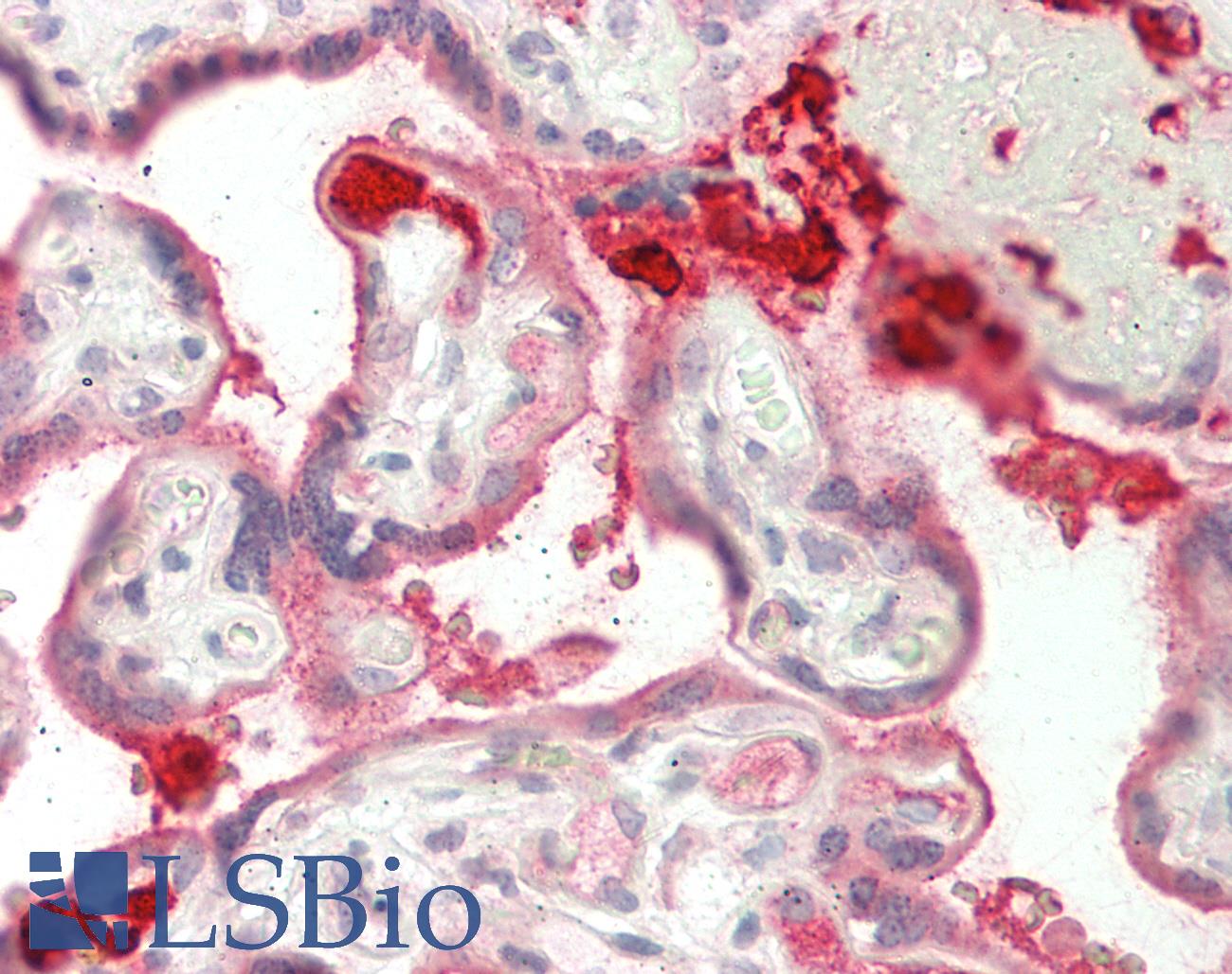 PECAM-1 / CD31 Antibody - Human Placenta: Formalin-Fixed, Paraffin-Embedded (FFPE)