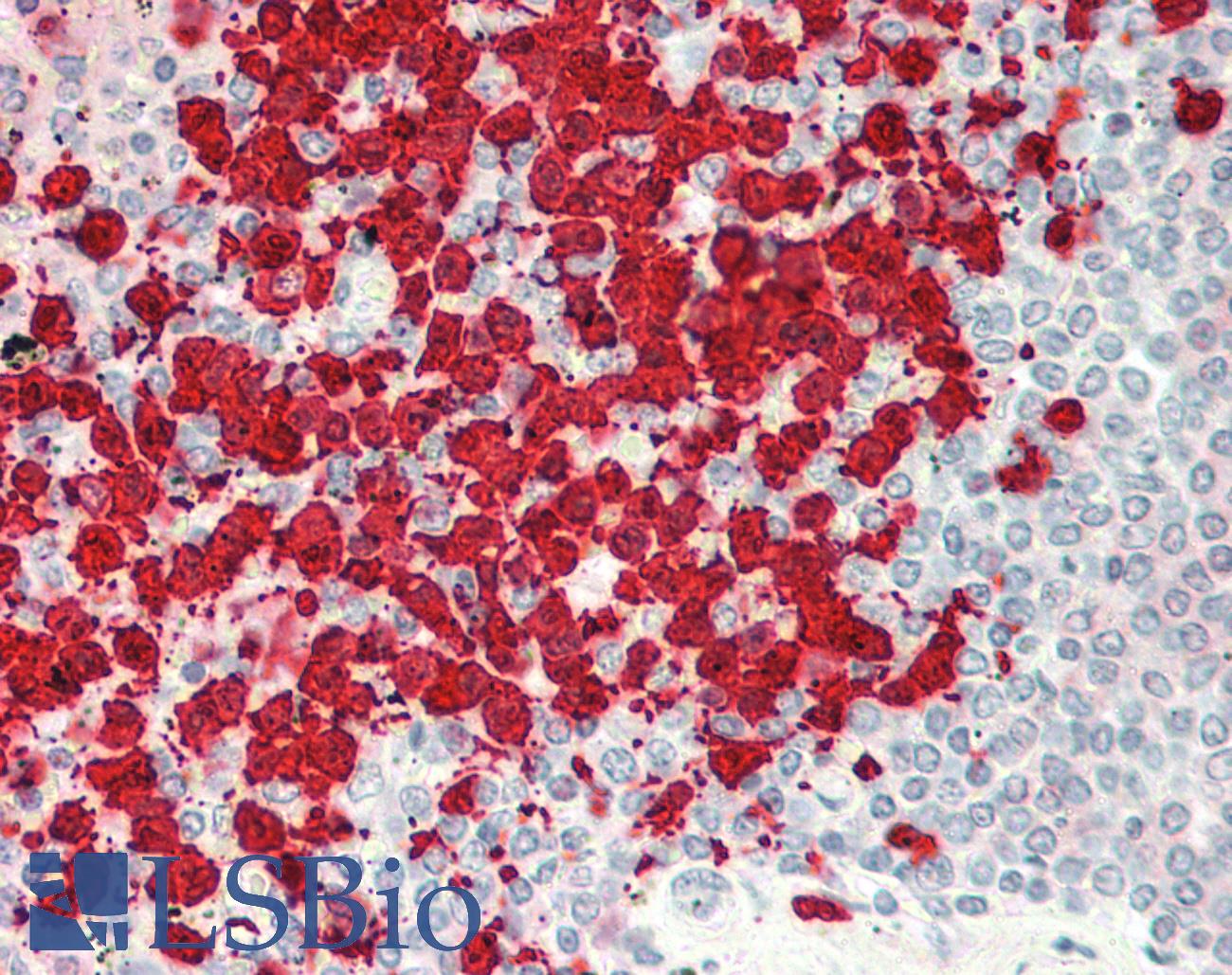 PECAM-1 / CD31 Antibody - Human Spleen: Formalin-Fixed, Paraffin-Embedded (FFPE)