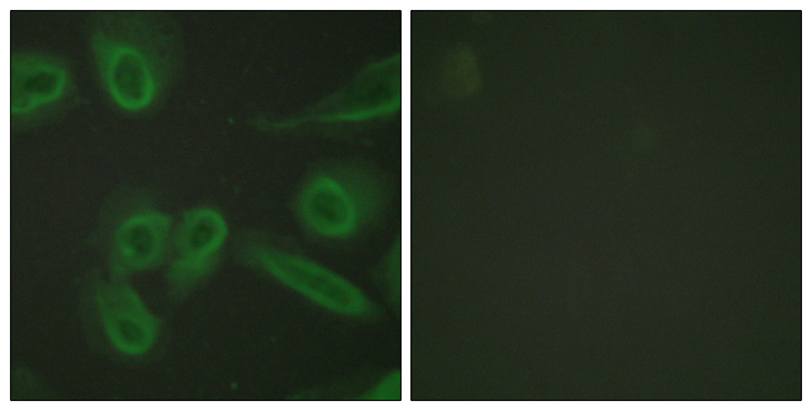 PECAM-1 / CD31 Antibody - Immunofluorescence analysis of HeLa cells, using PECAM-1 Antibody. The picture on the right is blocked with the synthesized peptide.