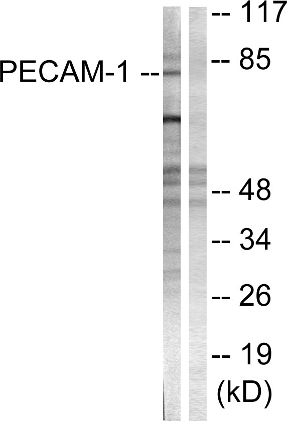 PECAM-1 / CD31 Antibody - Western blot analysis of lysates from Jurkat cells, using PECAM-1 Antibody. The lane on the right is blocked with the synthesized peptide.
