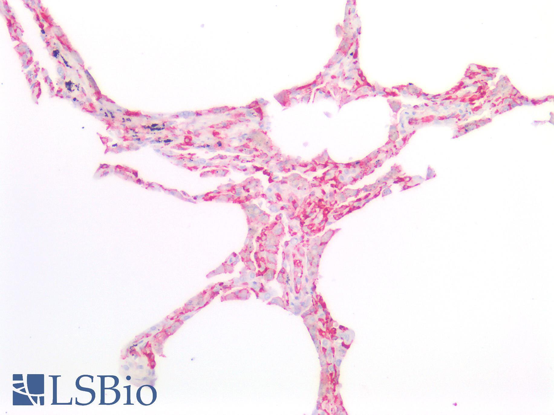 PECAM-1 / CD31 Antibody - Human Lung: Formalin-Fixed, Paraffin-Embedded (FFPE)