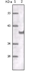PECAM-1 / CD31 Antibody - Western blot using CD31 mouse monoclonal antibody against truncated CD31 recombinant protein.