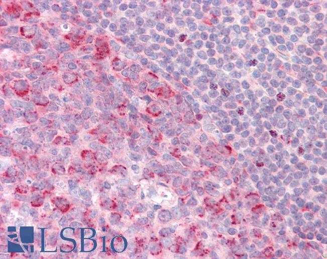 PELI1 / Pellino 1 Antibody - Anti-PELI1 / Pellino 1 antibody IHC staining of human tonsil. Immunohistochemistry of formalin-fixed, paraffin-embedded tissue after heat-induced antigen retrieval.
