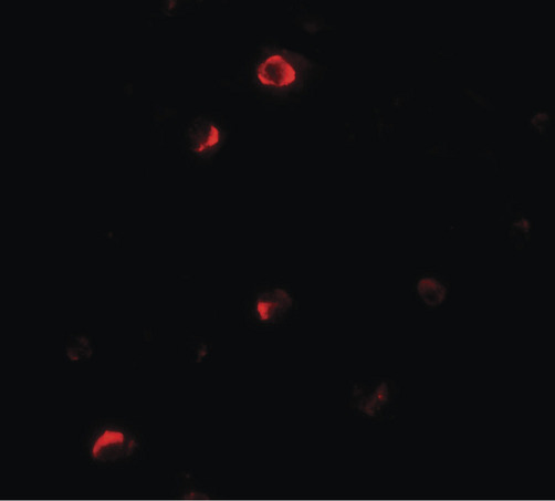 PELI1 / Pellino 1 Antibody - Immunofluorescence of Pellino 1 in HepG2 cells with Pellino 1 antibody at 20 ug/ml.