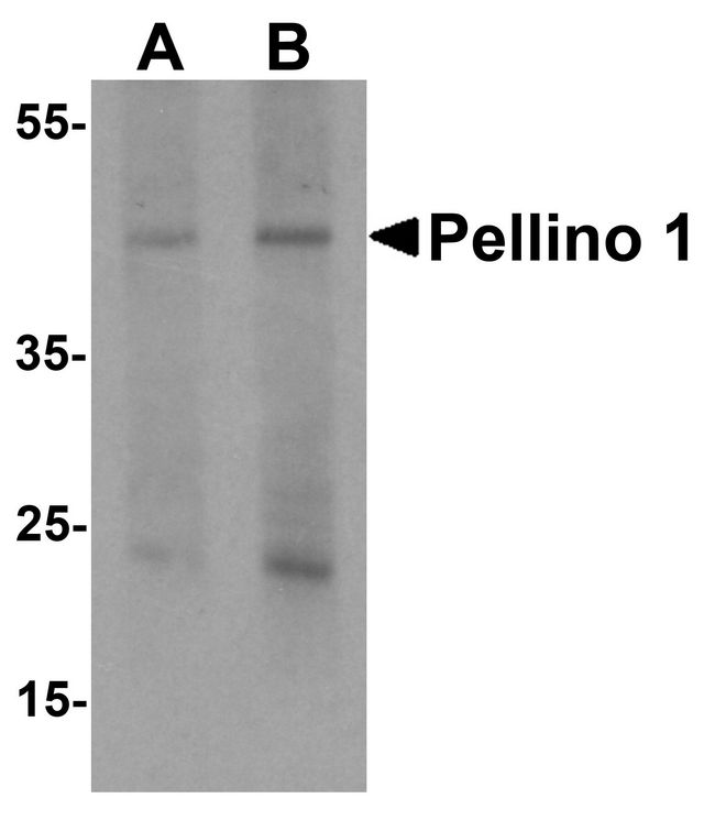 PELI1 / Pellino 1 Antibody - Western blot analysis of Pellino 1 in human liver tissue lysate with Pellino 1 antibody at (A) 1 and (B) 2 ug/ml.