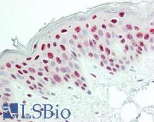 PELP1 Antibody - Human Skin: Formalin-Fixed, Paraffin-Embedded (FFPE)