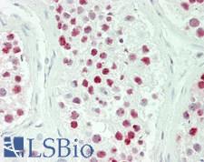 PELP1 Antibody - Human Testis: Formalin-Fixed, Paraffin-Embedded (FFPE)