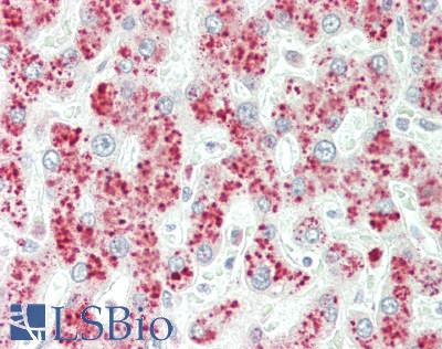 PEMT Antibody - Human Liver: Formalin-Fixed, Paraffin-Embedded (FFPE)