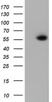 PEPD / PROLIDASE Antibody - HEK293T cells were transfected with the pCMV6-ENTRY control (Left lane) or pCMV6-ENTRY PEPD (Right lane) cDNA for 48 hrs and lysed. Equivalent amounts of cell lysates (5 ug per lane) were separated by SDS-PAGE and immunoblotted with anti-PEPD.