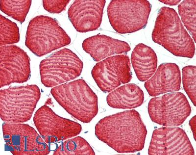 PER2 Antibody - Human Skeletal Muscle: Formalin-Fixed, Paraffin-Embedded (FFPE)
