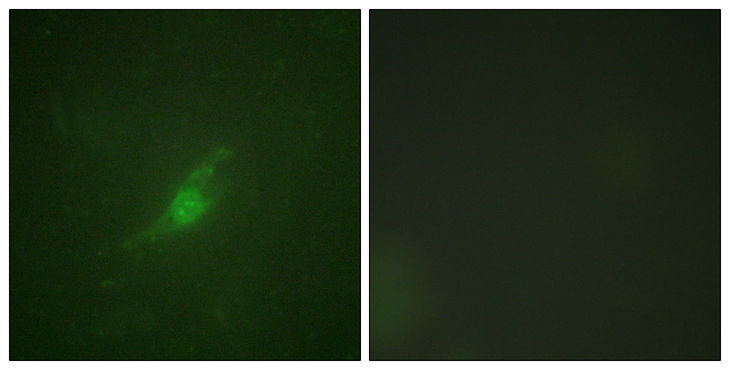 PER2 Antibody - Immunofluorescence analysis of NIH/3T3 cells, using Period Circadian Protein 2 Antibody. The picture on the right is blocked with the synthesized peptide.