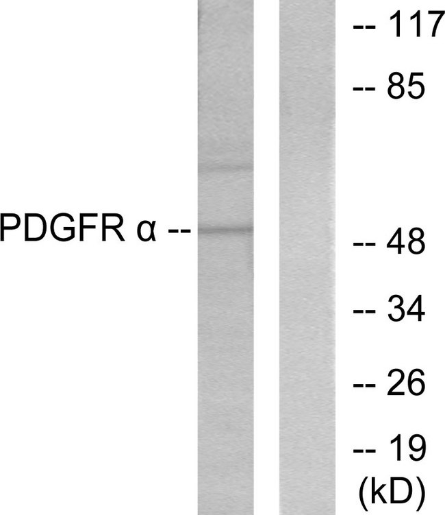 Peripherin Antibody - Western blot analysis of lysates from HepG2 cells, using Peripherin Antibody. The lane on the right is blocked with the synthesized peptide.