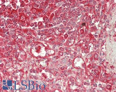 PES1 Antibody - Human Spleen: Formalin-Fixed, Paraffin-Embedded (FFPE)