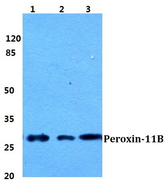 PEX11B Antibody - Western blot analysis of Anti-PEX11B Antibody at a 1:500 dilution. Lane 1: MCF-7 cell lysate. Lane 2: Raw264.7 cell lysate. Lane 3: PC12 cell lysate.