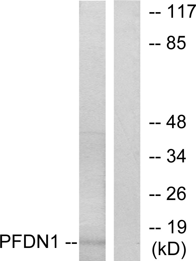 PFDN1 Antibody - Western blot analysis of lysates from RAW264.7 cells, using PFDN1 Antibody. The lane on the right is blocked with the synthesized peptide.