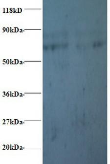 PFDN5 / MM1 Antibody - Western blot of Prefoldin subunit 5 antibody at 2 ug/ml. Lane 1: EC109whole cell lysate. Lane 2: 293T whole cell lysate. Secondary: Goat polyclonal to Rabbit IgG at 1:15000 dilution. Predicted band size: 17 kDa. Observed band size: 70 kDa Additional bands at: 80 kDa. We are unsure as to the identity of these extra band.  This image was taken for the unconjugated form of this product. Other forms have not been tested.