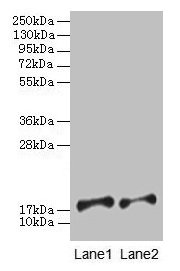 PFDN5 / MM1 Antibody - Western blot All lanes: Prefoldin subunit 5 antibody at 2µg/ml Lane 1: EC109whole cell lysate Lane 2: 293T whole cell lysate Secondary Goat polyclonal to rabbit IgG at 1/15000 dilution Predicted band size: 18, 8, 13 kDa Observed band size: 18 kDa
