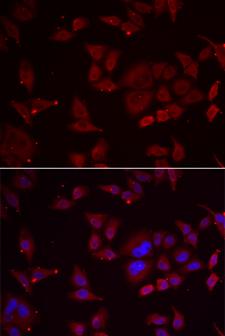 PFK2 / PFKFB3 Antibody - Immunofluorescence analysis of U2OS cell using PFKFB3 antibody. Blue: DAPI for nuclear staining.