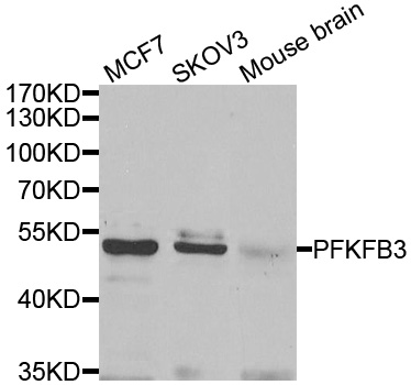 PFK2 / PFKFB3 Antibody - Western blot analysis of extracts of various cell lines, using PFKFB3 antibody.