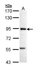 PFKM / PFK-1 Antibody - Sample (30 ug of whole cell lysate). A: A431 . 7.5% SDS PAGE. PFKM antibody diluted at 1:5000.