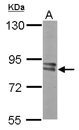 PFKM / PFK-1 Antibody - Sample (50 ug of whole cell lysate). A: Mouse brain. 7.5% SDS PAGE. PFKM antibody diluted at 1:2000.