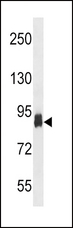 PFKP Antibody - PFKP Antibody (D769) western blot of T47D cell line lysates (35 ug/lane). The PFKP antibody detected the PFKP protein (arrow).