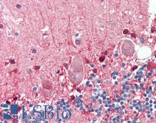 PGAM1 Antibody - Human Brain, Cerebellum: Formalin-Fixed, Paraffin-Embedded (FFPE)
