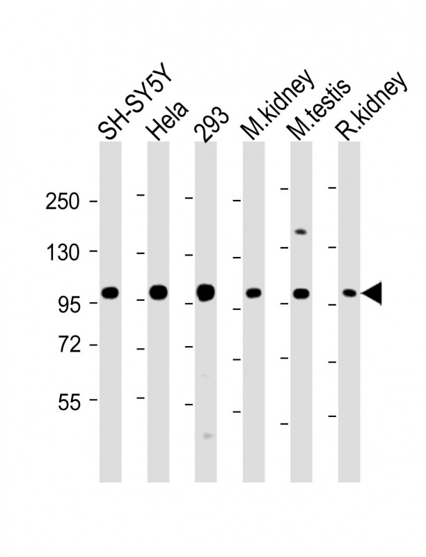 PGAP1 Antibody - All lanes: Anti-PGAP1 Antibody (N-Term) at 1:2000 dilution Lane 1: SH-SY5Y whole cell lysate Lane 2: Hela whole cell lysate Lane 3: 293 whole cell lysate Lane 4: mouse kidney lysate Lane 5: mouse testis lysate Lane 6: rat kidney lysate Lysates/proteins at 20 µg per lane. Secondary Goat Anti-Rabbit IgG, (H+L), Peroxidase conjugated at 1/10000 dilution. Predicted band size: 105 kDa Blocking/Dilution buffer: 5% NFDM/TBST.