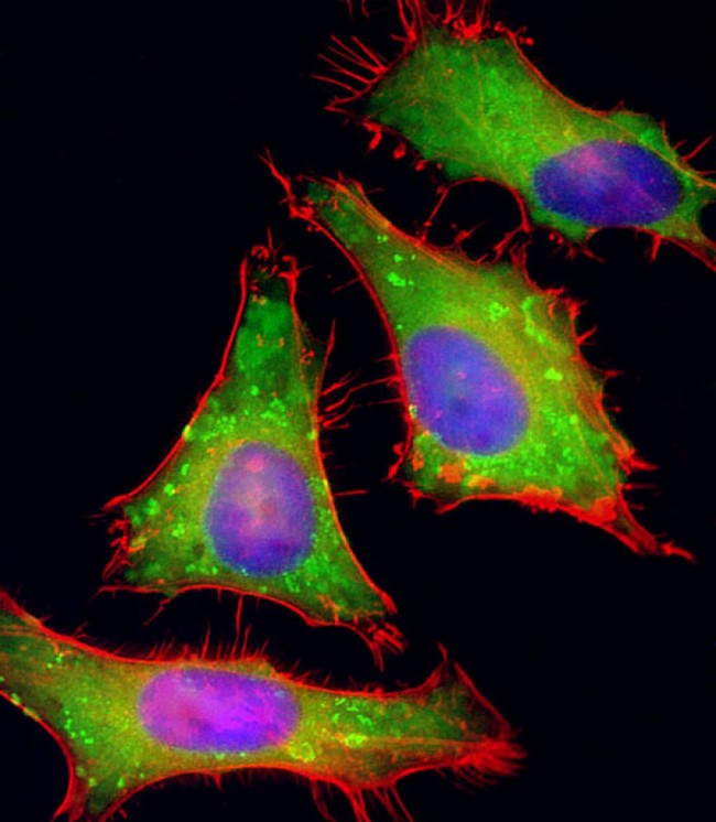 PGAP1 Antibody - Immunofluorescent analysis of 4% paraformaldehyde-fixed, 0.1% Triton X-100 permeabilized HeLa (human cervical epithelial adenocarcinoma cell line) cells labeling PGAP1 with PGAP1 Antibody (N-Term) at 1/25 dilution, followed by Dylight® 488-conjugated goat anti-rabbit IgG (1583138) secondary antibody at 1/200 dilution (green). Immunofluorescence image showing cytoplasm staining on HeLa cell line. Cytoplasmic actin is detected with Dylight® 554 Phalloidin (OI17558410) at 1/100 dilution (red).The nuclear counter stain is DAPI (blue).