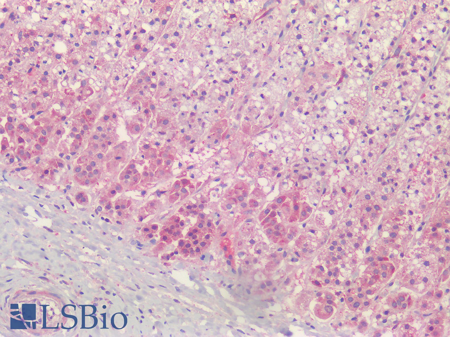 PGAP1 Antibody - Human Adrenal: Formalin-Fixed, Paraffin-Embedded (FFPE)