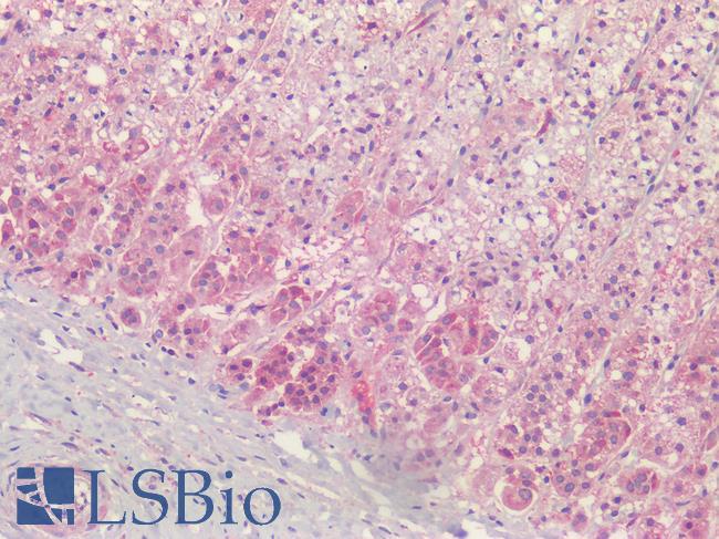 PGAP1 Antibody - Human Adrenal: Formalin-Fixed, Paraffin-Embedded (FFPE)