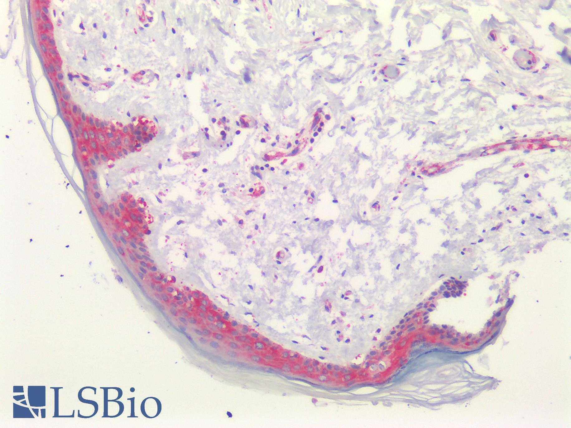 PGAP1 Antibody - Human Skin: Formalin-Fixed, Paraffin-Embedded (FFPE)