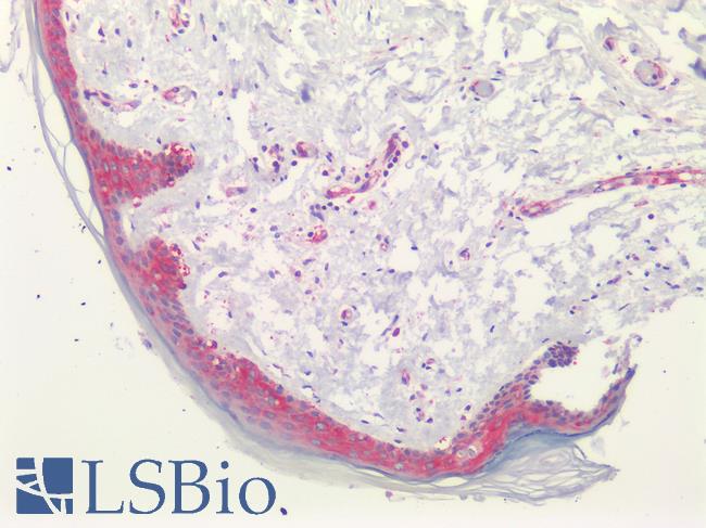 PGAP1 Antibody - Human Skin: Formalin-Fixed, Paraffin-Embedded (FFPE)