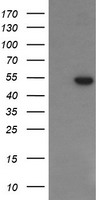 PGD Antibody - HEK293T cells were transfected with the pCMV6-ENTRY control (Left lane) or pCMV6-ENTRY PGD (Right lane) cDNA for 48 hrs and lysed. Equivalent amounts of cell lysates (5 ug per lane) were separated by SDS-PAGE and immunoblotted with anti-PGD.