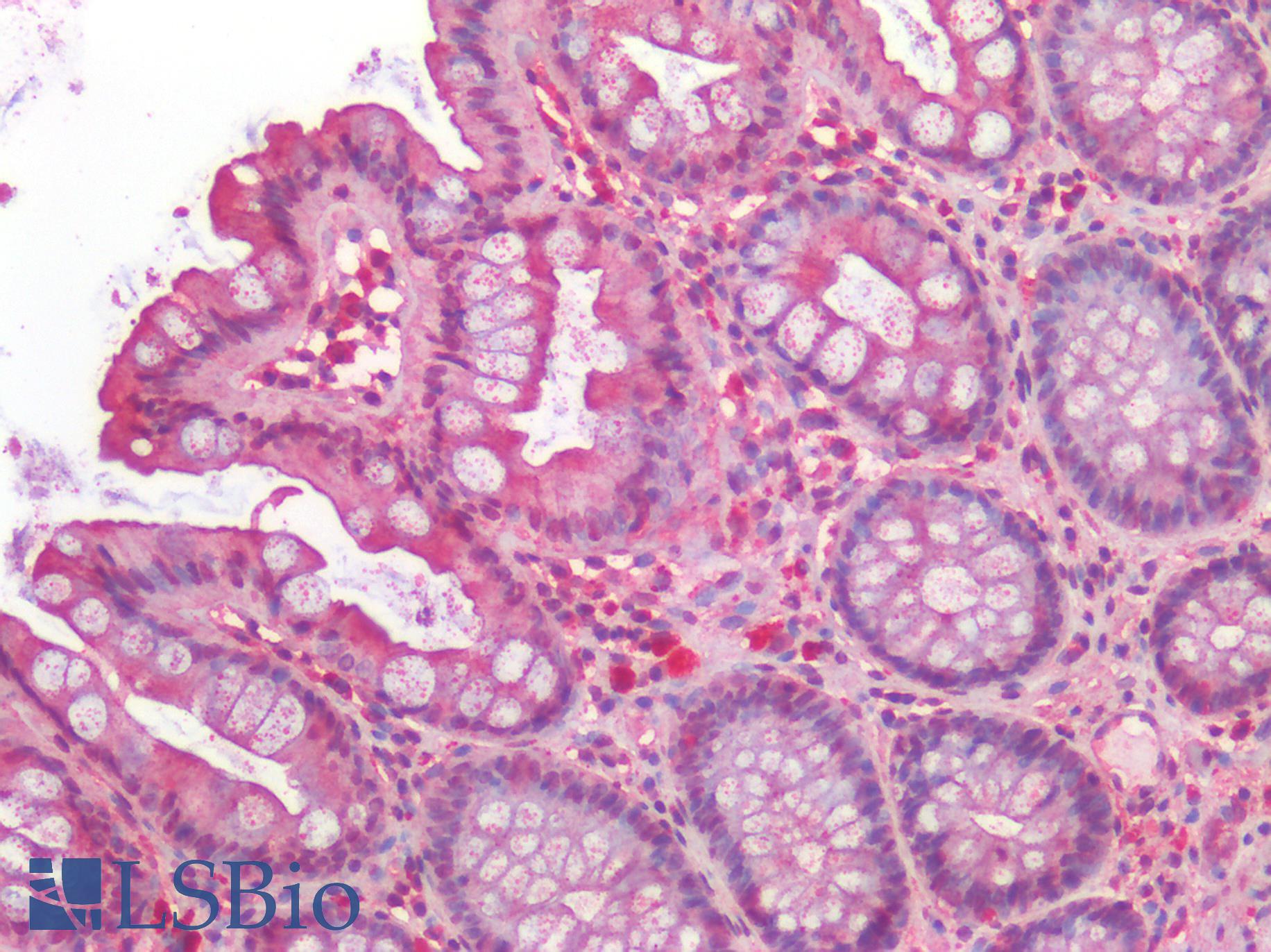PGES / PTGES Antibody - Human Colon: Formalin-Fixed, Paraffin-Embedded (FFPE)
