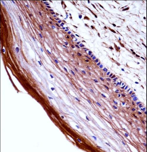 PGF / PLGF Antibody - PGF Antibody immunohistochemistry of formalin-fixed and paraffin-embedded human cervix tissue followed by peroxidase-conjugated secondary antibody and DAB staining.
