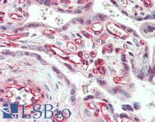 PGF / PLGF Antibody - Human Placenta: Formalin-Fixed, Paraffin-Embedded (FFPE)