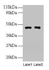 PGK1 / Phosphoglycerate Kinase Antibody - Western blot All lanes: Phosphoglycerate kinase 1 antibody at 2µg/ml Lane 1: EC109 whole cell lysate Lane 2: 293T whole cell lysate Secondary Goat polyclonal to rabbit IgG at 1/15000 dilution Predicted band size: 45, 42 kDa Observed band size: 45 kDa