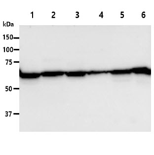 PGM1 / Phosphoglucomutase 1 Antibody - The Cell lysates (40ug) were resolved by SDS-PAGE, transferred to PVDF membrane and probed with anti-human PGM1 antibody (1:1000). Proteins were visualized using a goat anti-mouse secondary antibody conjugated to HRP and an ECL detection system. Lane 1. : 293T cell lysate Lane 2. : HepG2 cell lysate Lane 3. : NIH/3T3 cell lysate Lane 4. : Jurkat cell lysate Lane 5. : HeLa cell lysate Lane 6. : U87MG cell lysate