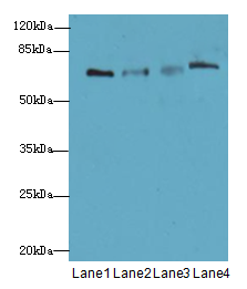 PGM2L1 Antibody - Western blot. All lanes: PGM2L1 antibody at 0.8 ug/ml. Lane 1: HL60 whole cell lysate. Lane 2: HepG-2 whole cell lysate. Lane 3: Caco-2 whole cell lysate. Lane 4: MCF7 whole cell lysate. Secondary Goat polyclonal to Rabbit IgG at 1:10000 dilution. Predicted band size: 70 kDa. Observed band size: 70 kDa.
