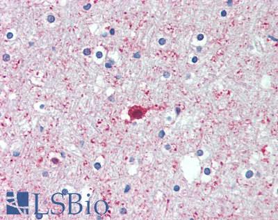 PGM2L1 Antibody - Human Brain, Cortex: Formalin-Fixed, Paraffin-Embedded (FFPE), at a concentration of 10 ug/ml. 