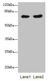 PGM2L1 Antibody - Western blot All lanes: PGM2L1 antibody at 0.8µg/ml Lane 1: HL60 whole cell lysate Lane 2: HepG2 whole cell lysate Lane 3: Caco-2 whole cell lysate Lane 4: MCF-7 whole cell lysate Secondary Goat polyclonal to rabbit IgG at 1/10000 dilution Predicted band size: 70 kDa Observed band size: 70 kDa