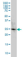 PGRMC2 Antibody - Western blot of PGRMC2 expression in HeLa.