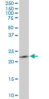 PGRMC2 Antibody - Western blot of PGRMC2 expression in PC-12.