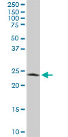 PGRMC2 Antibody - Western blot of PGRMC2 expression in NIH/3T3.