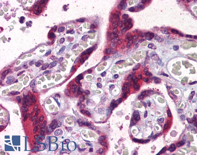 PGRMC2 Antibody - Anti-PGRMC2 antibody IHC of human placenta. Immunohistochemistry of formalin-fixed, paraffin-embedded tissue after heat-induced antigen retrieval. Antibody concentration 1 ug/ml.