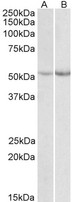 PH / PAH Antibody - Goat Anti-Phenylalanine Hydroxylase Antibody (0.1µg/ml) staining of Mouse (A) and Rat (B) Liver lysate (35µg protein in RIPA buffer). Detected by chemiluminescencence.