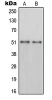 PH / PAH Antibody - Western blot analysis of PAH expression in HepG2 (A); mouse liver (B) whole cell lysates.