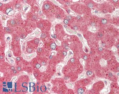 PH / PAH Antibody - Human Liver: Formalin-Fixed, Paraffin-Embedded (FFPE)