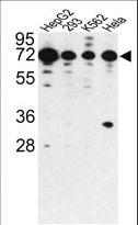 PHACTR2 Antibody - Western blot of PHACTR2 antibody in HepG2, 293, K562 and HeLa cell line lysates (35 ug/lane). PHACTR2 (arrow) was detected using the purified antibody.